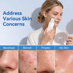 ready to ship: Pore Cleaner gezichts-spatel, ultrasonische gezichtsreiniger, dieptereiniging, ultrasonische huidreiniger